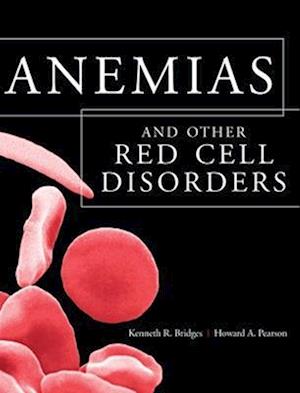 Anemias and Other Red Cell Disorders