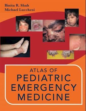 Atlas of pediatric emergency medicine