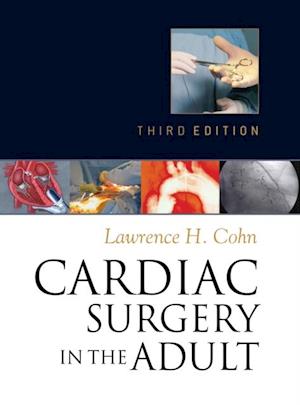 Cardiac Surgery in the Adult, Third Edition