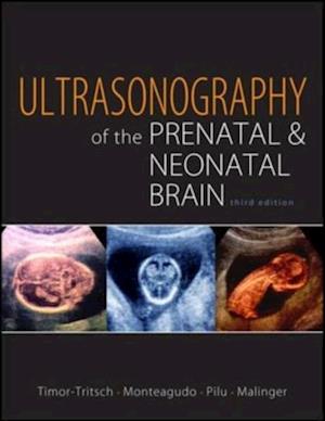 Ultrasonography of the Prenatal Brain, Third Edition