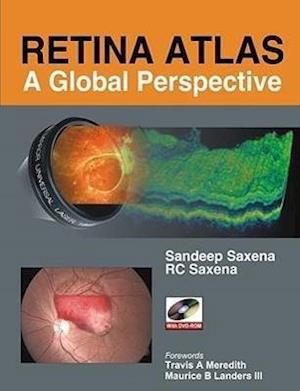 Retina Atlas