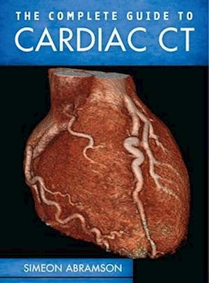 The Complete Guide to Cardiac CT