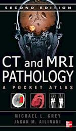 CT & MRI Pathology: A Pocket Atlas, Second Edition