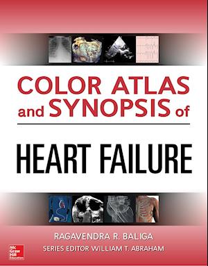 Color Atlas and Synopsis of Heart Failure