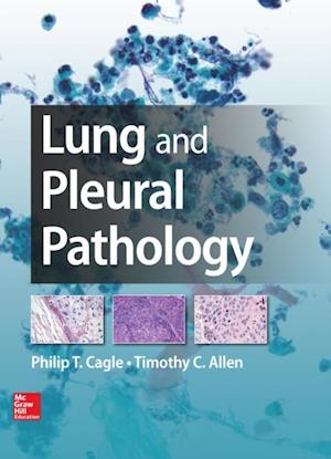 Lung and Pleural Pathology