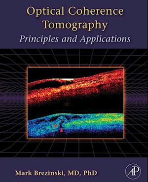 Optical Coherence Tomography