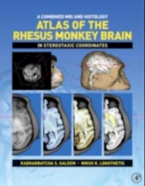 Combined MRI and Histology Atlas of the Rhesus Monkey Brain in Stereotaxic Coordinates