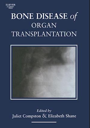 Bone Disease of Organ Transplantation