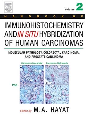 Handbook of Immunohistochemistry and in Situ Hybridization of Human Carcinomas