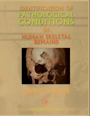 Identification of Pathological Conditions in Human Skeletal Remains