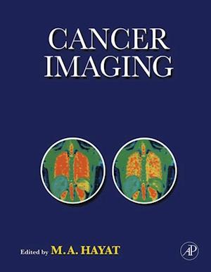 Cancer Imaging