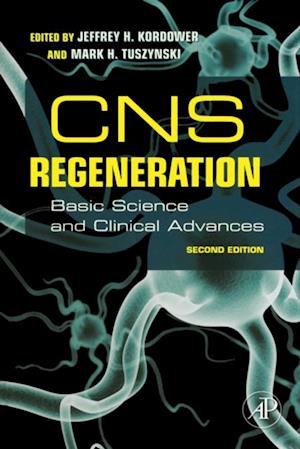 CNS Regeneration