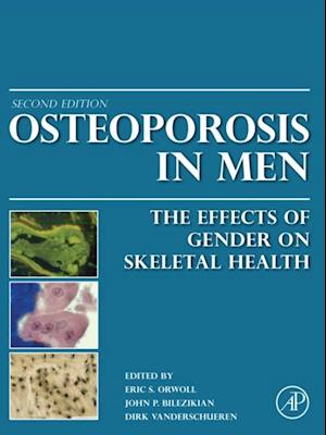 Osteoporosis in Men