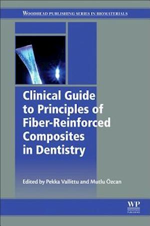 Clinical Guide to Principles of Fiber-Reinforced Composites in Dentistry