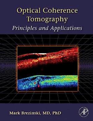 Optical Coherence Tomography