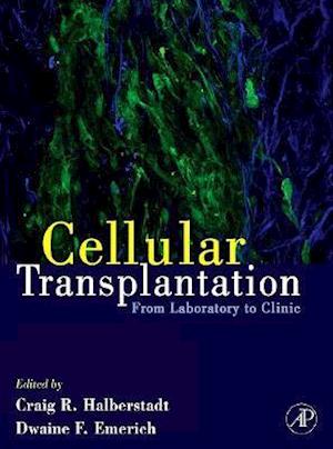 Cellular Transplantation