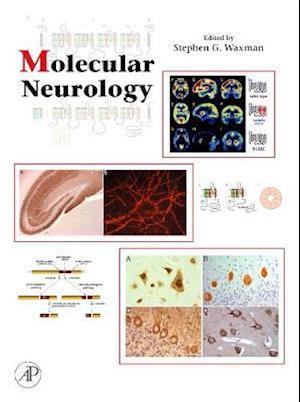 Molecular Neurology