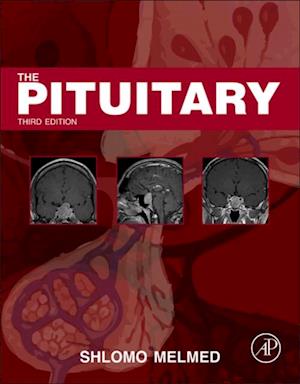 Pituitary