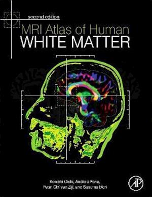 MRI Atlas of Human White Matter