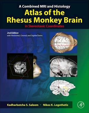 Combined MRI and Histology Atlas of the Rhesus Monkey Brain in Stereotaxic Coordinates