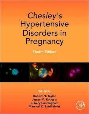 Chesley's Hypertensive Disorders in Pregnancy