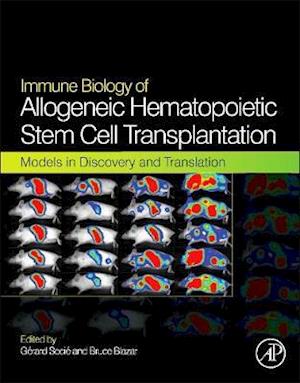 Immune Biology of Allogeneic Hematopoietic Stem Cell Transplantation