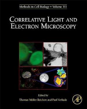 Correlative Light and Electron MIcroscopy