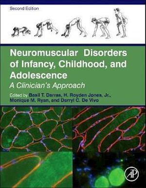 Neuromuscular Disorders of Infancy, Childhood, and Adolescence