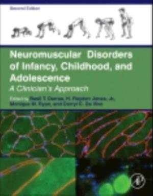 Neuromuscular Disorders of Infancy, Childhood, and Adolescence