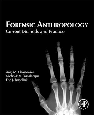 Forensic Anthropology