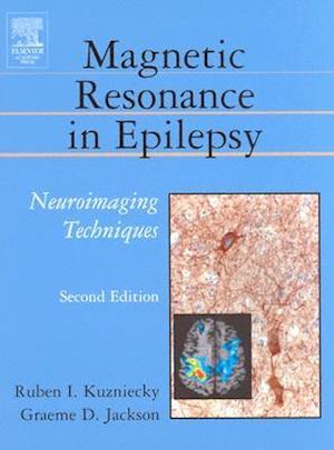 Magnetic Resonance in Epilepsy