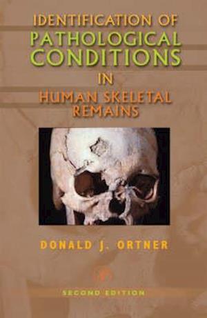 Identification of Pathological Conditions in Human Skeletal Remains