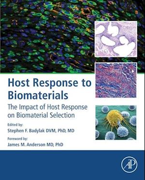 Host Response to Biomaterials