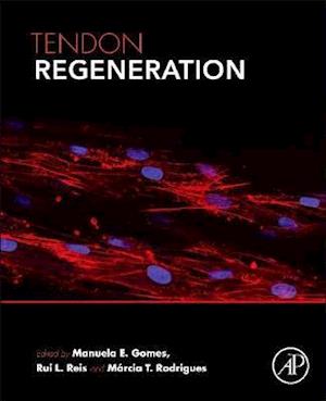 Tendon Regeneration