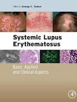 Systemic Lupus Erythematosus