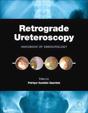 Retrograde Ureteroscopy