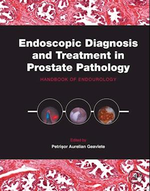 Endoscopic Diagnosis and Treatment in Prostate Pathology