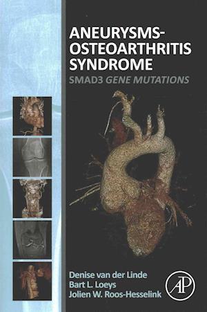 Aneurysms-Osteoarthritis Syndrome