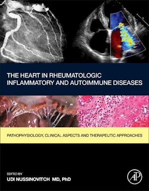 Heart in Rheumatic, Autoimmune and Inflammatory Diseases