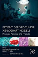 Patient Derived Tumor Xenograft Models