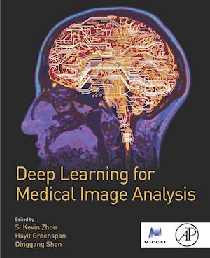 Deep Learning for Medical Image Analysis