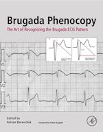 Brugada Phenocopy