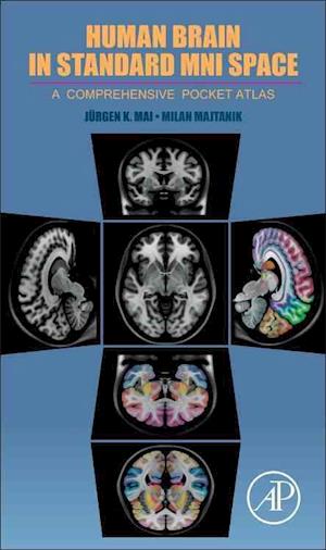 Human Brain in Standard MNI Space