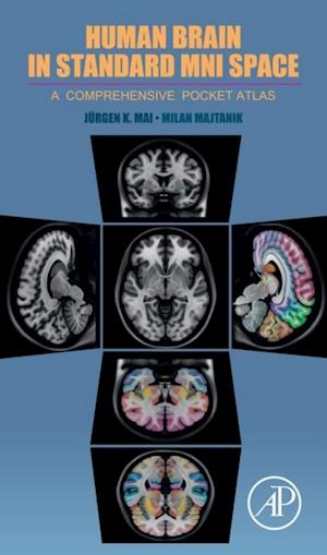 Human Brain in Standard MNI Space