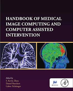 Handbook of Medical Image Computing and Computer Assisted Intervention