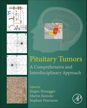 Pituitary Tumors