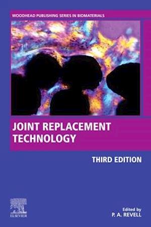 Joint Replacement Technology