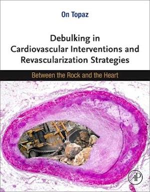 Debulking in Cardiovascular Interventions and Revascularization Strategies