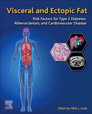 Visceral and Ectopic Fat