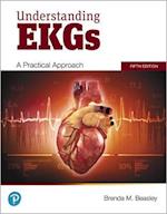 Understanding EKGs